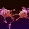 cellula-tumorale